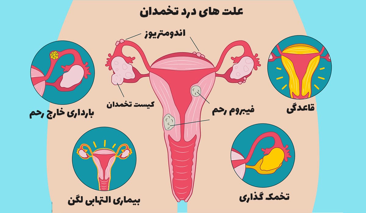 علت های درد تخمدان